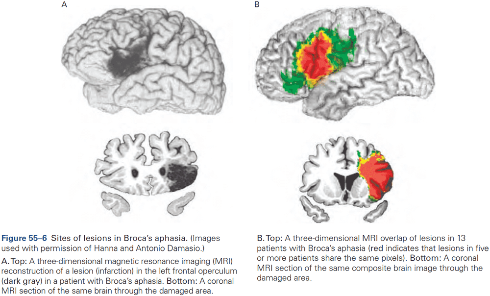 Figure 55.6