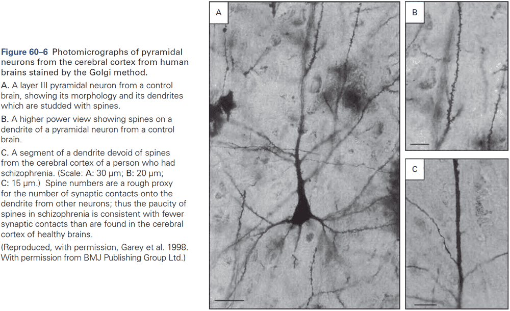 Figure 60.6