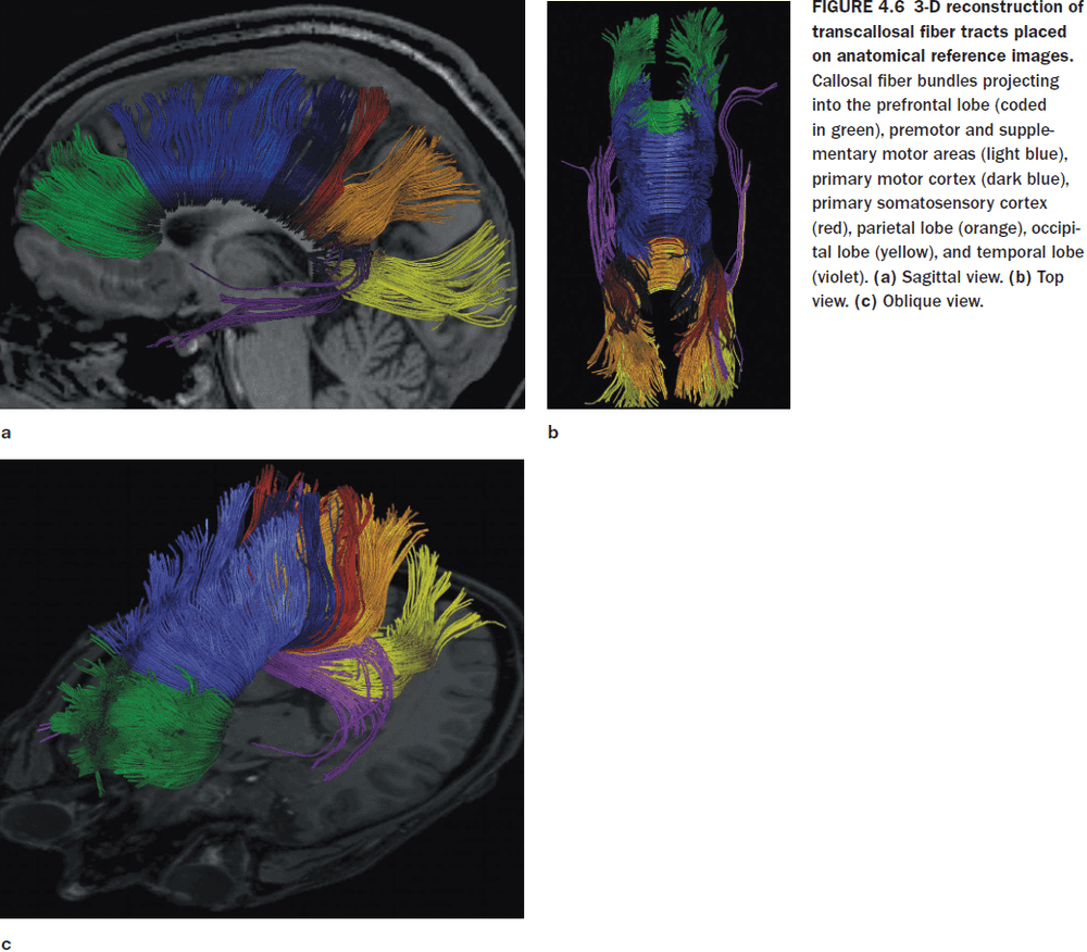 Figure 4.6